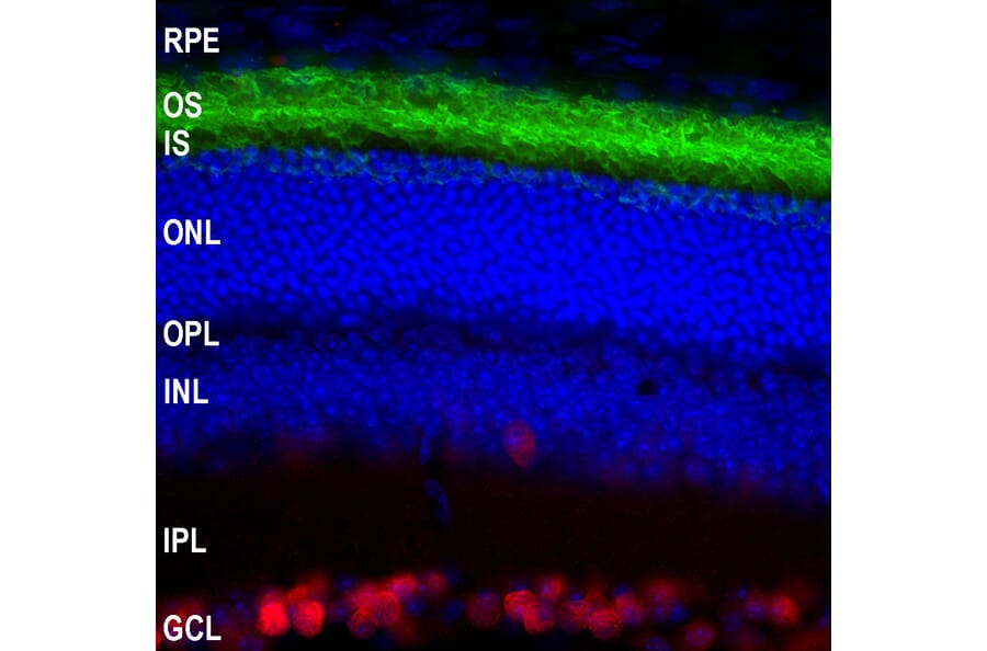 Immunofluorescence - Anti-Rhodopsin Antibody [B630] (A85373) - Antibodies.com