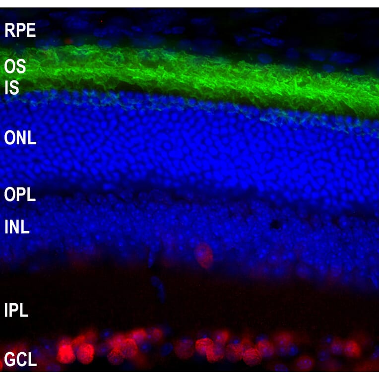 Immunofluorescence - Anti-Rhodopsin Antibody [B630] (A85373) - Antibodies.com