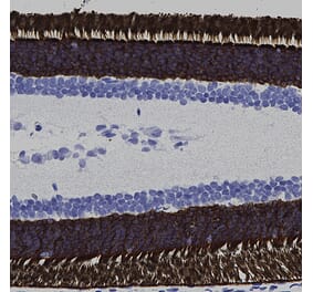 Immunohistochemistry - Anti-Rhodopsin Antibody [A531] (A85374) - Antibodies.com