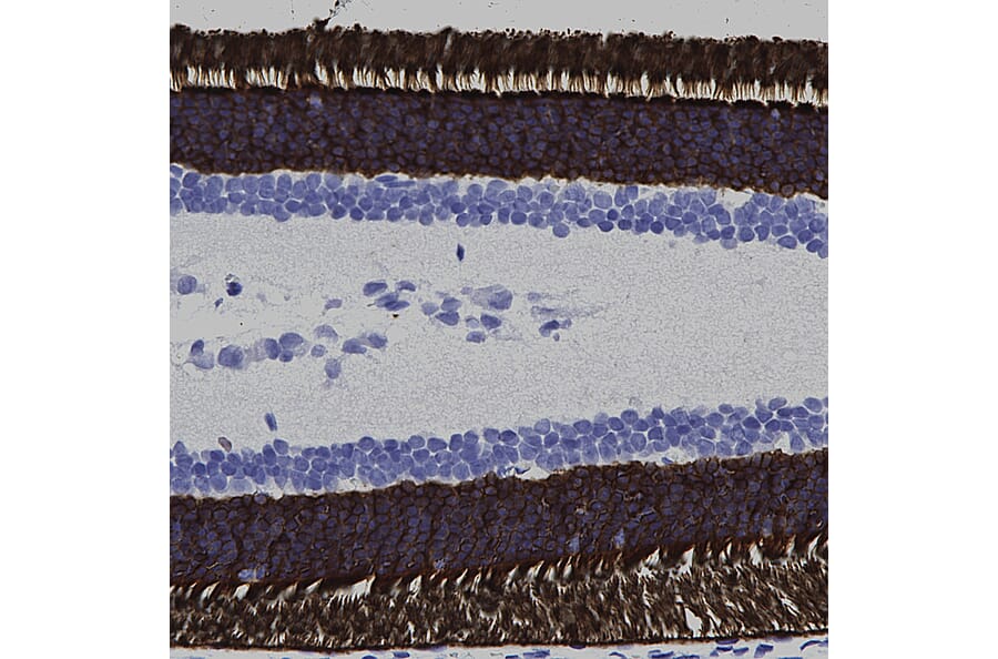 Immunohistochemistry - Anti-Rhodopsin Antibody [A531] (A85374) - Antibodies.com