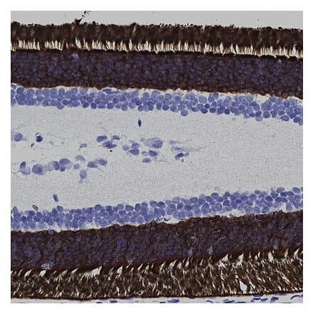 Immunohistochemistry - Anti-Rhodopsin Antibody [A531] (A85374) - Antibodies.com