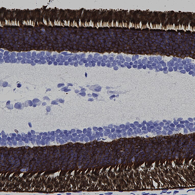 Immunohistochemistry - Anti-Rhodopsin Antibody [A531] (A85374) - Antibodies.com
