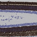 Immunohistochemistry - Anti-Rhodopsin Antibody [A531] (A85374) - Antibodies.com