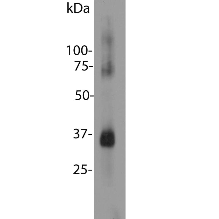 Western Blot - Anti-Rhodopsin Antibody (A85374) - Antibodies.com