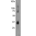 Western Blot - Anti-Rhodopsin Antibody (A85374) - Antibodies.com