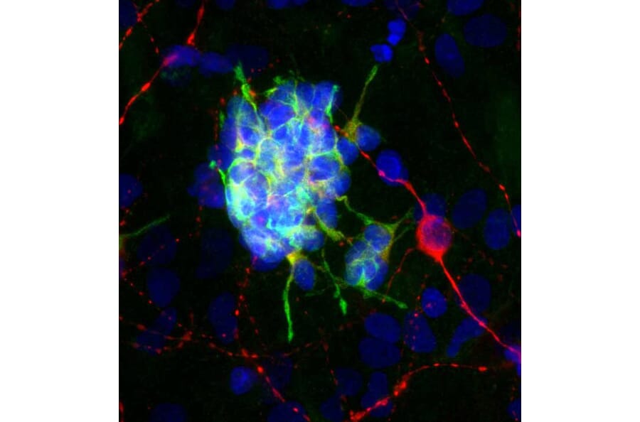 Immunofluorescence - Anti-Doublecortin Antibody [3E1] (A85376) - Antibodies.com