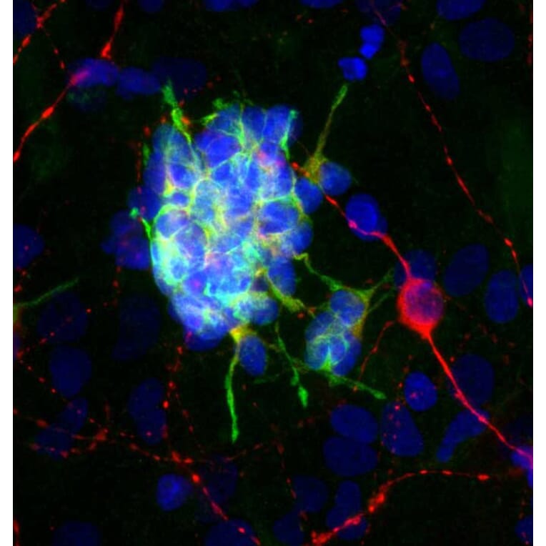 Immunofluorescence - Anti-Doublecortin Antibody [3E1] (A85376) - Antibodies.com