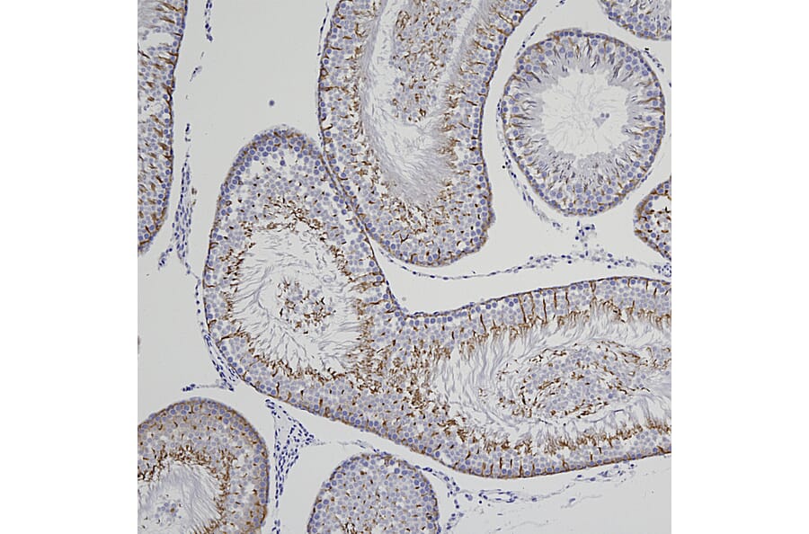 Immunohistochemistry - Anti-Doublecortin Antibody [3E1] (A85376) - Antibodies.com