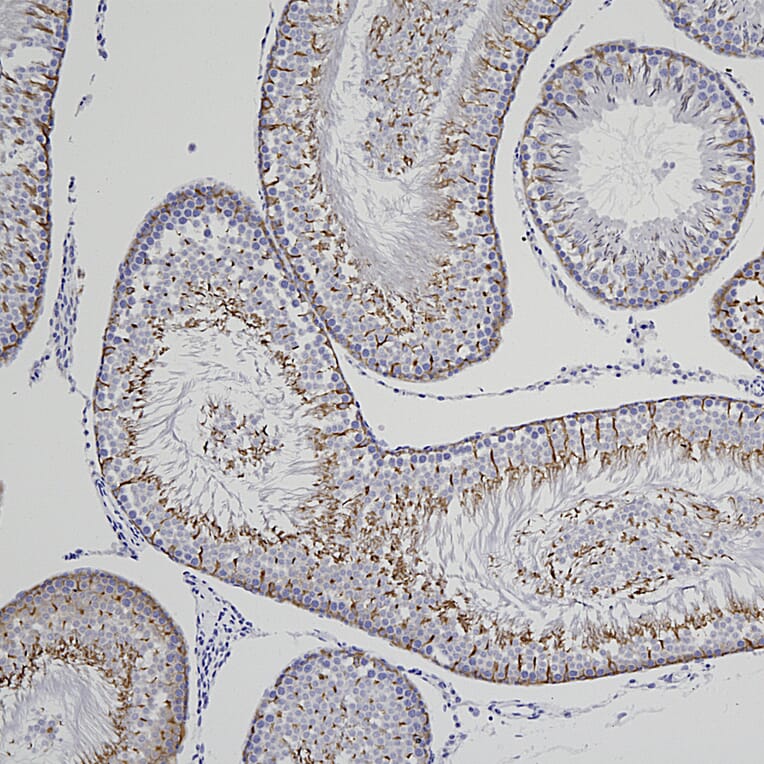 Immunohistochemistry - Anti-Doublecortin Antibody [3E1] (A85376) - Antibodies.com