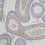 Immunohistochemistry - Anti-Doublecortin Antibody [3E1] (A85376) - Antibodies.com