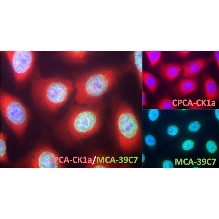 Immunofluorescence - Anti-Casein Kinase 1 Alpha Antibody (A85378) - Antibodies.com