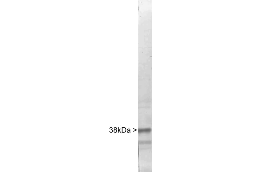 Western Blot - Anti-Casein Kinase 1 Alpha Antibody (A85378) - Antibodies.com