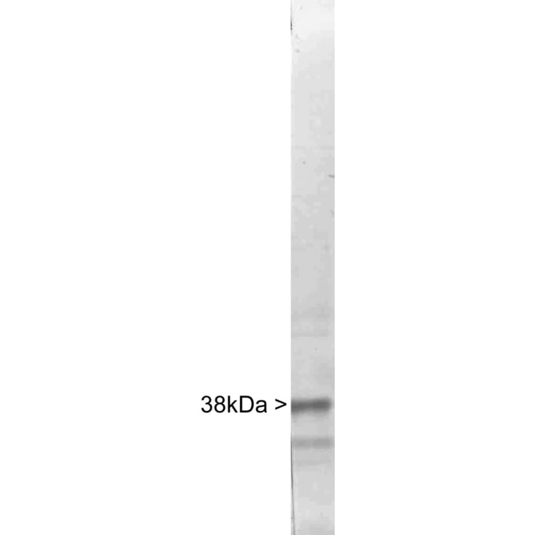 Western Blot - Anti-Casein Kinase 1 Alpha Antibody (A85378) - Antibodies.com