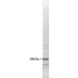 Western Blot - Anti-Casein Kinase 1 Alpha Antibody (A85378) - Antibodies.com