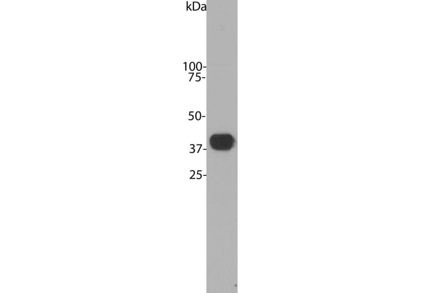Western Blot - Anti-Aldolase C Antibody [4A9] (A85385) - Antibodies.com