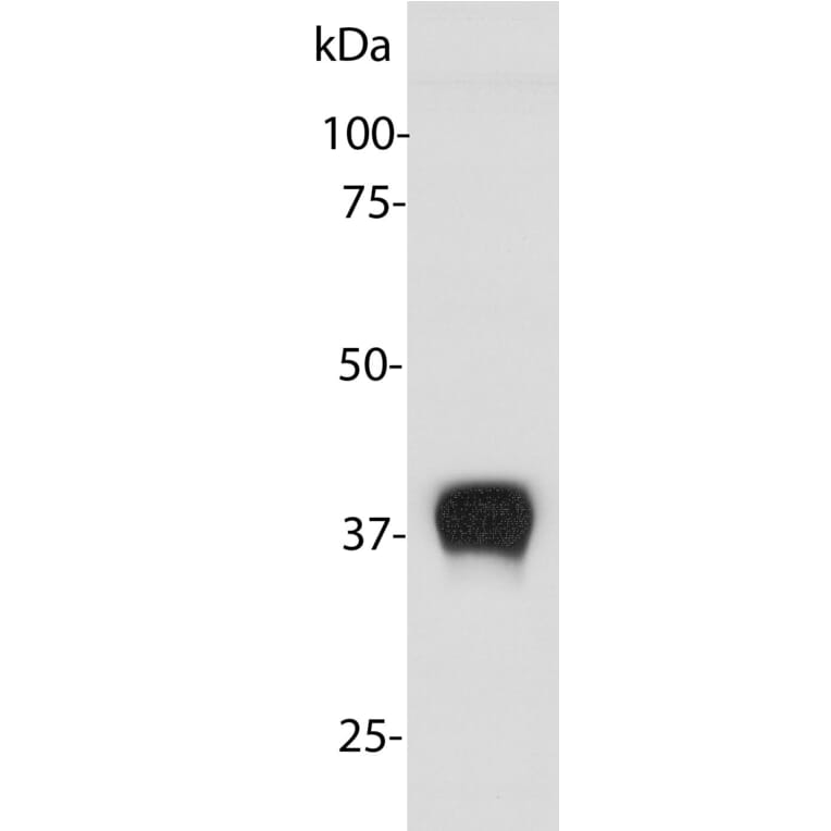 Western Blot - Anti-Aldolase C Antibody (A85386) - Antibodies.com