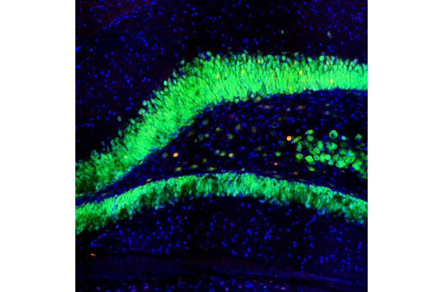 Immunofluorescence - Anti-c-Fos Antibody [2H2] (A85387) - Antibodies.com