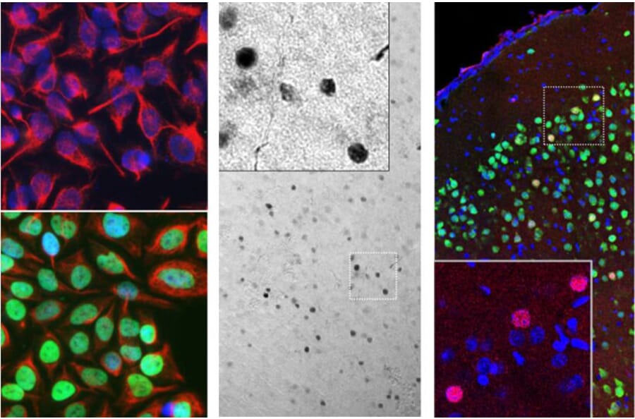 Immunofluorescence - Anti-c-Fos Antibody [2H2] (A85387) - Antibodies.com