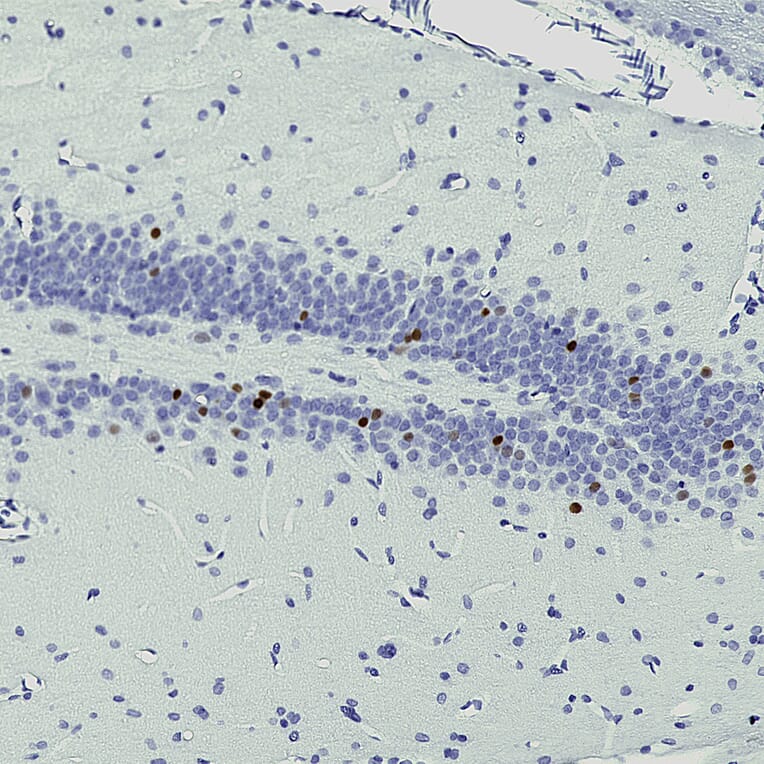 Immunohistochemistry - Anti-c-Fos Antibody [2H2] (A85387) - Antibodies.com