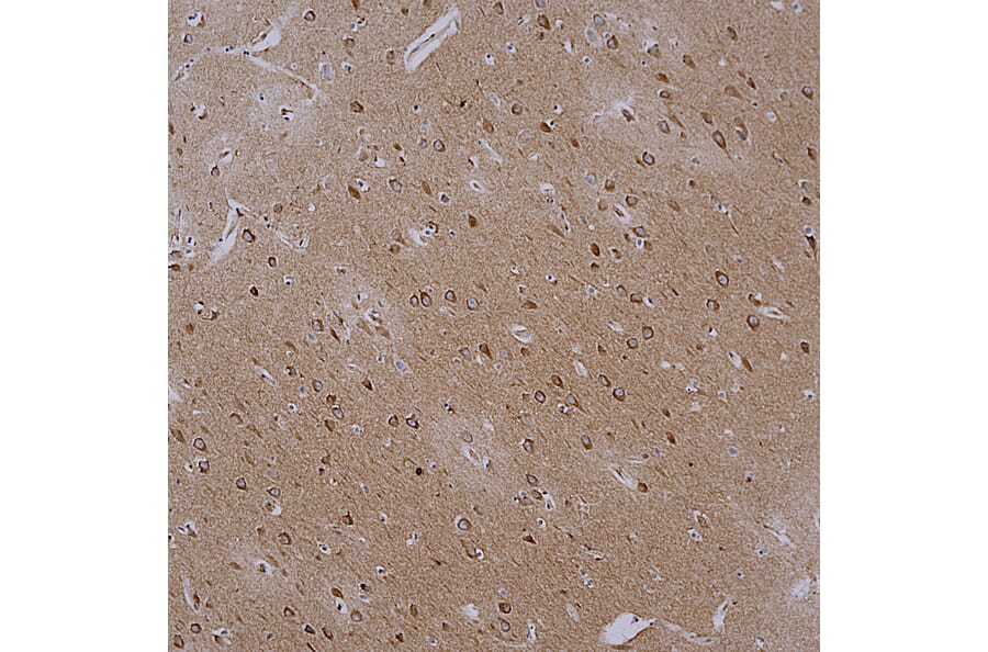 Immunohistochemistry - Anti-Actin Antibody [5J11] (A85388) - Antibodies.com