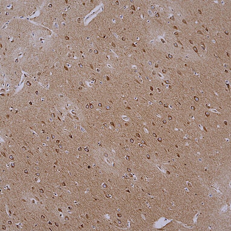Immunohistochemistry - Anti-Actin Antibody [5J11] (A85388) - Antibodies.com