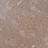 Immunohistochemistry - Anti-Actin Antibody [5J11] (A85388) - Antibodies.com