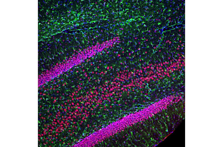 Immunofluorescence - Anti-TDP43 Antibody [3H8] (A85389) - Antibodies.com