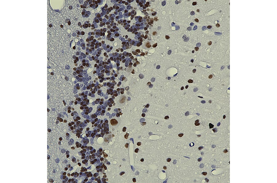 Immunohistochemistry - Anti-TDP43 Antibody [3H8] (A85389) - Antibodies.com