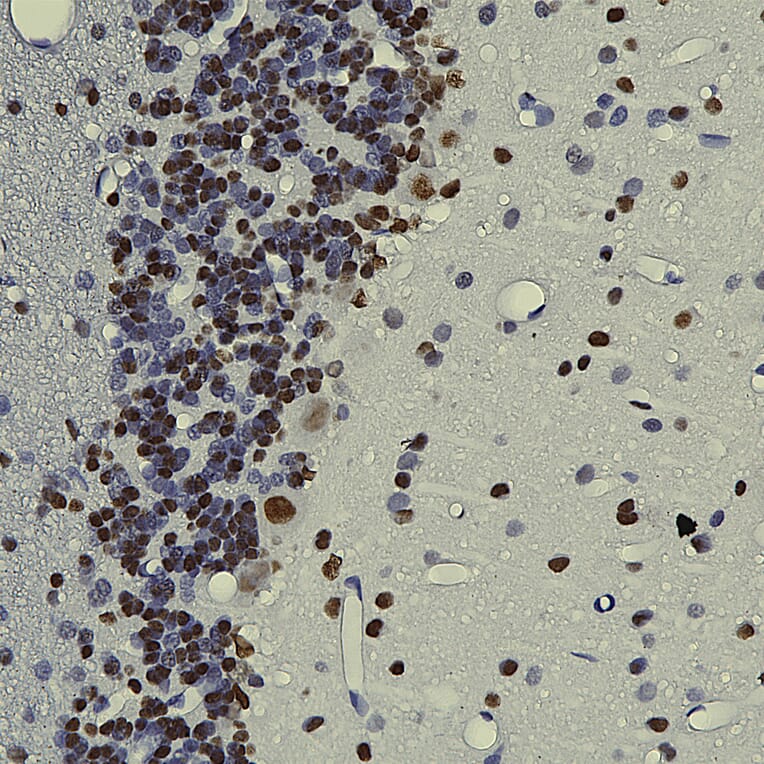 Immunohistochemistry - Anti-TDP43 Antibody [3H8] (A85389) - Antibodies.com
