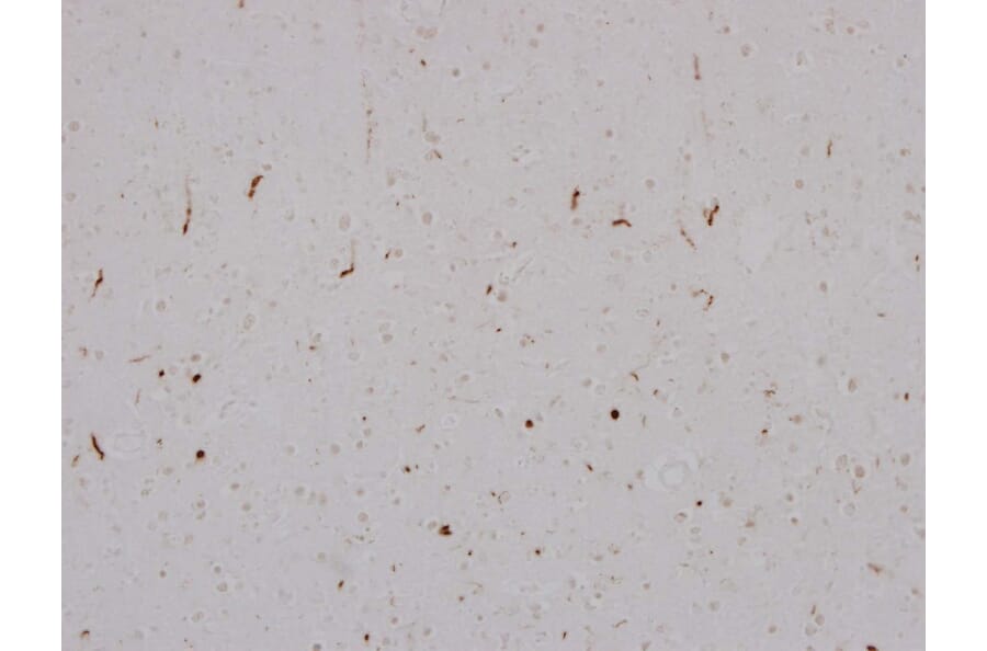 Immunohistochemistry - Anti-TDP43 Antibody [3H8] (A85389) - Antibodies.com