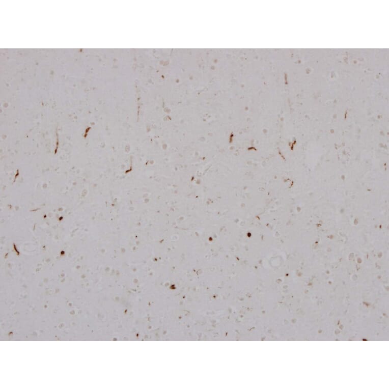 Immunohistochemistry - Anti-TDP43 Antibody [3H8] (A85389) - Antibodies.com