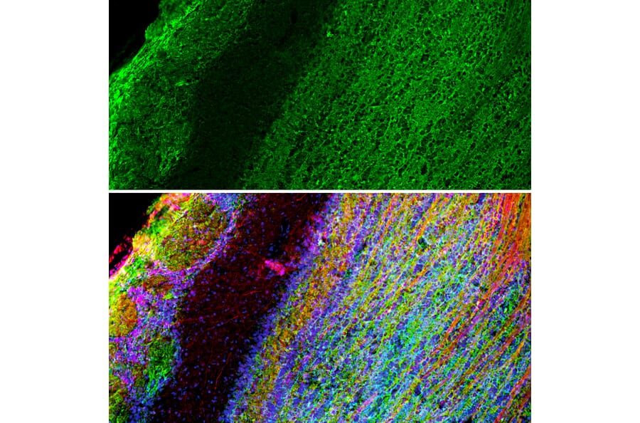 Immunofluorescence - Anti-GAP43 Antibody [1E3] (A85391) - Antibodies.com