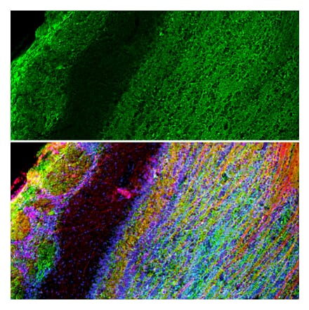 Immunofluorescence - Anti-GAP43 Antibody [1E3] (A85391) - Antibodies.com