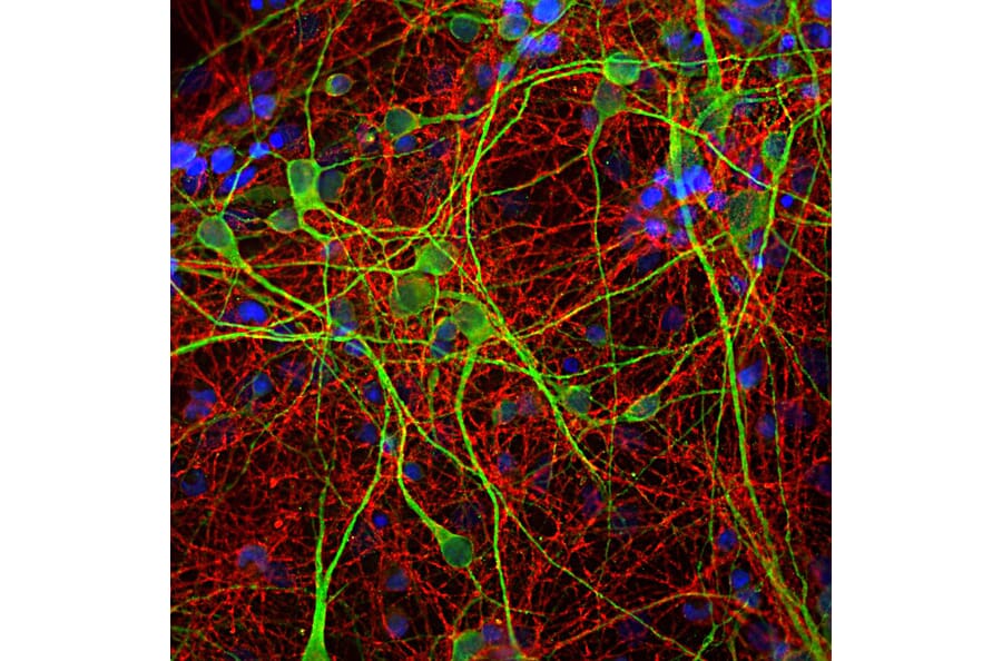 IHC analysis of rat cortical neuron-glial cell culture