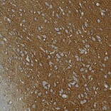 Immunohistochemistry - Anti-GAP43 Antibody [3H14] (A85393) - Antibodies.com