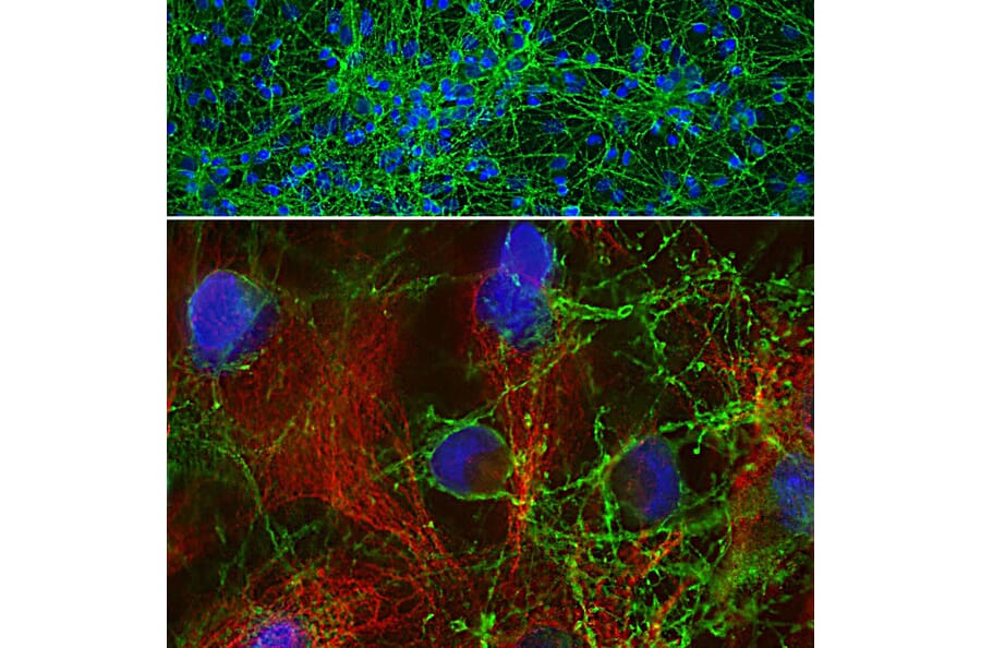 Immunofluorescence - Anti-GAP43 Antibody (A85394) - Antibodies.com