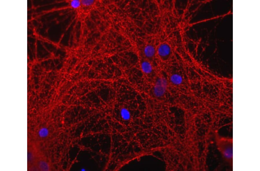 Immunofluorescence - Anti-GAP43 Antibody (A85394) - Antibodies.com