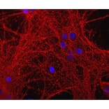Immunofluorescence - Anti-GAP43 Antibody (A85394) - Antibodies.com