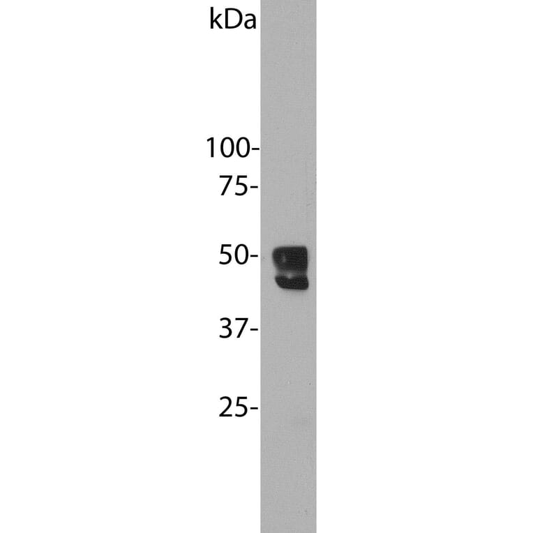 Western Blot - Anti-Fox1 Antibody (A85396) - Antibodies.com