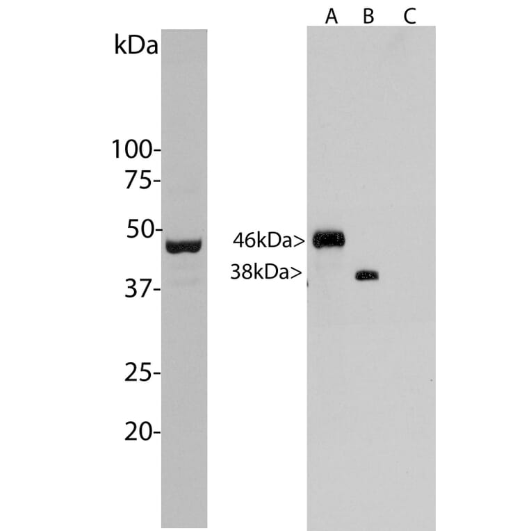 Western Blot - Anti-Aurora A + B Kinase Antibody [5A12] (A85399) - Antibodies.com