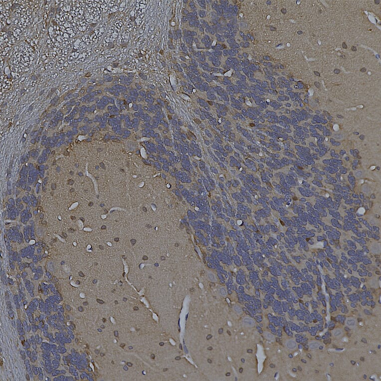 Immunohistochemistry - Anti-Enolase 1 Antibody [253] (A85406) - Antibodies.com