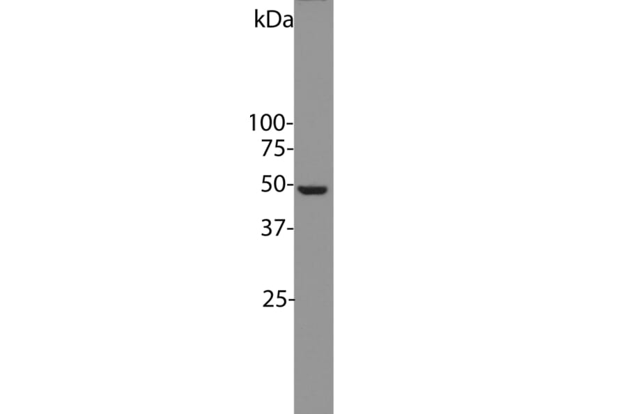 Western Blot - Anti-Enolase 1 Antibody [253] (A85406) - Antibodies.com