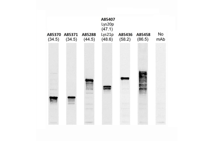Western Blot - Anti-Lys20p + Lys21p Antibody [31F5] (A85407) - Antibodies.com
