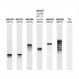 Western Blot - Anti-Lys20p + Lys21p Antibody [31F5] (A85407) - Antibodies.com
