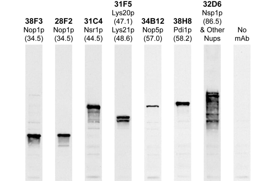 Western Blot - Anti-Lys20p + Lys21p Antibody [31F5] (A85407) - Antibodies.com