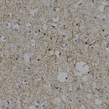 Immunohistochemistry - Anti-CNPase Antibody (A85409) - Antibodies.com
