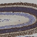 Immunohistochemistry - Anti-Arrestin 1 Antibody [S128] (A85410) - Antibodies.com