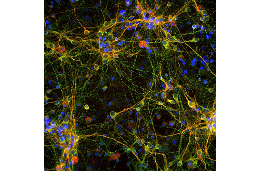 Immunofluorescence - Anti-Tau Antibody (A85414) - Antibodies.com