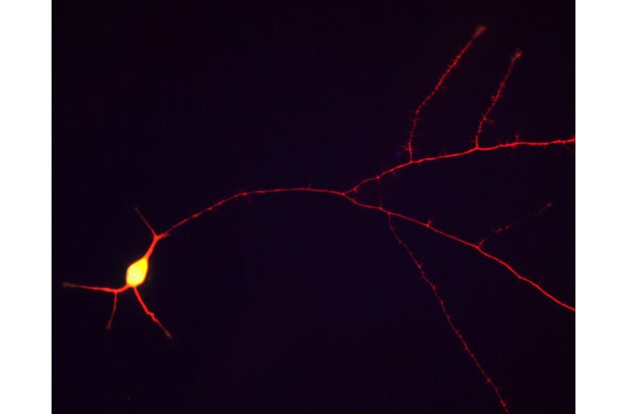 Immunofluorescence - Anti-Tau Antibody (A85414) - Antibodies.com