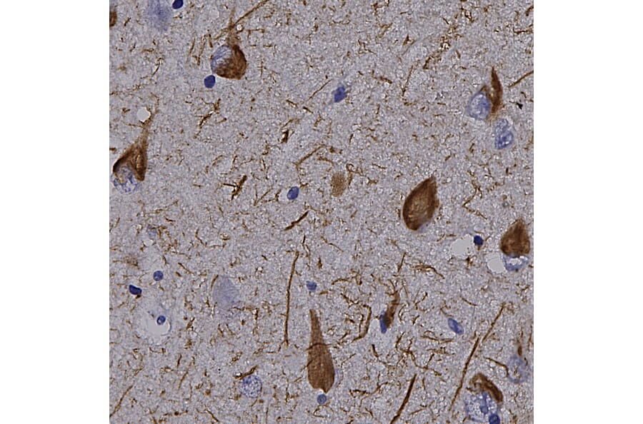 Immunohistochemistry - Anti-Tau Antibody (A85414) - Antibodies.com